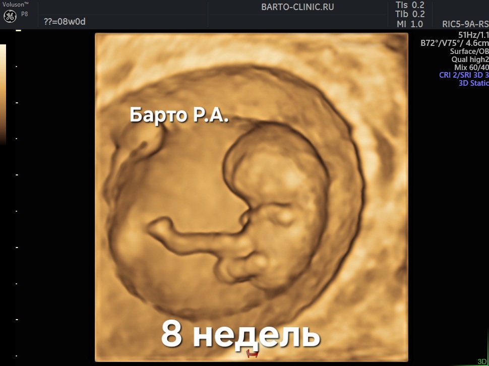 3D embryo image 8 weeks of gestation